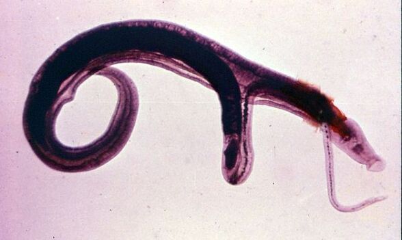 血吸虫是最常见和最危险的寄生虫之一